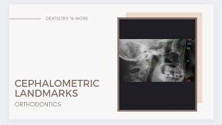 CEPHALOMETRIC LANDMARKS