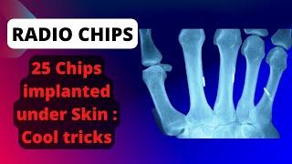 Under Skin 25 Chip Implants | Cool tricks performed | Mahadees