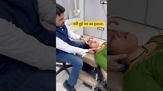 दबी हुई नस का इलाज।chiropractic treatment #trend #feed #ytshort #feedshort