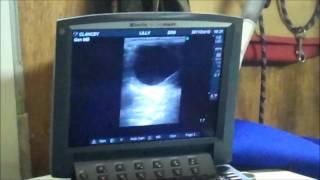 Equine fertility scaning using Sonosite MicroMaxx - BCF Technology video