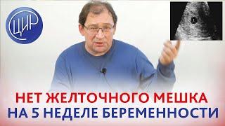 5 неделя беременности. Нет желточного мешка. Может ли это быть многоплодная беременность?