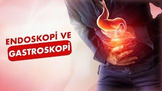 Endoskopi ve Gastroskopi Uygulaması│Prof. Dr. Murat Sarıkaya