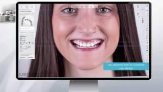 3Shape RealView™ Engine - Next Generation 3D Digital Smile Design