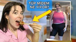 TÜP MİDEM BİR GÜN BOYUNCA NE YİYOR? 1 Sene Güncellemesi