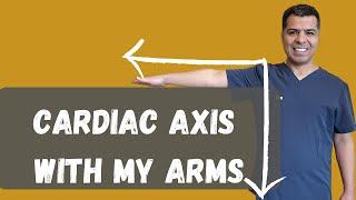 Explained Cardiac Axis