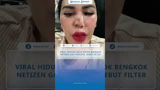 VIRAL Hidung Ratu Entok Bengkok Minta Tanggungjawab Dokter, Netizen Tak Percaya Sebut Filter