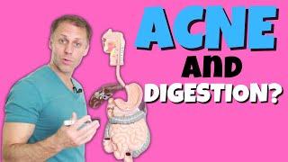 Is Acne Caused by Digestive Issues