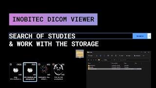 The search of studies and work with the storage with Inobitec DICOM Viewer