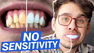 Snow Teeth Whitening Kit Review | My Honest Thoughts