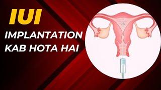 IUI ke kitne dino ke baad implantation hoti hai