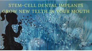 Stem Cell Dental Implants Grow New Teeth in Your Mouth