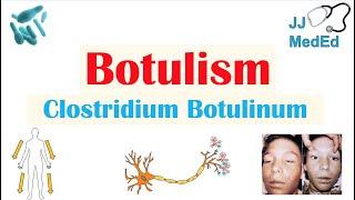 Botulism (Clostridium Botulinum) Pathogenesis, Symptoms, Diagnosis, Treatment, Prevention