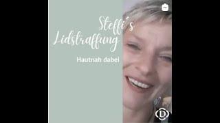 Steffis Lidstraffung – hautnah dabei