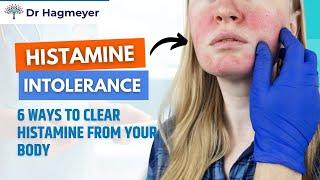 How to Clear Histamine- How To Get Rid of Histamine in 6 Easy Steps Dr. Richard Hagmeyer