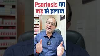 Psoriasis का जड़ से इलाज। Cure Psoriasis With Homeopathy | Best Treatment of Psoriasis