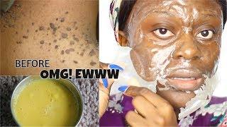 DIY MILK BLACKHEAD PEEL OFF MASK | UNCLUG  BLACKHEADS, WHITEHEADS AND UNWANTED FACIAL HAIR