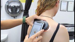 WHAT DOES A SKIN CANCER CHECK INVOLVE//GETTING A SKIN CANCER CHECK AT CHEVRON ADVANCED MEDICAL QLD//