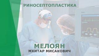 Риносептопластика | Мелоян Мхитар Мисакович | Пластический хирург КОРЛ Казань