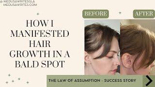 How I Manifested Hair Growth | Law of Assumption Success Story