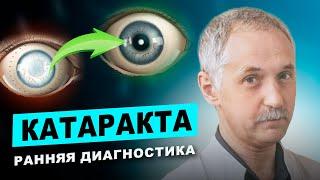 Катаракта: Симптомы, которые вы не должны игнорировать! / Доктор Виктор