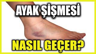 Ayak Şişmesine Ne iyi Gelir? Ayak Şişmesi Neden Olur?