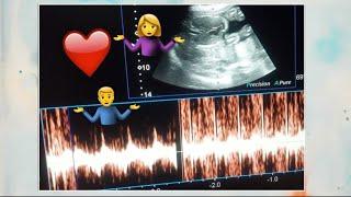 baby gender reveal ultrasound | Live baby scan | heart rate se baby gender | baby movements | usg