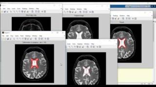 Matlab based ieee projects