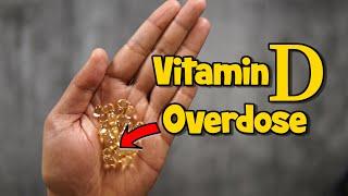 I Took 10,000 IUs of Vitamin D3 Supplement Every Day for 6 Months !!