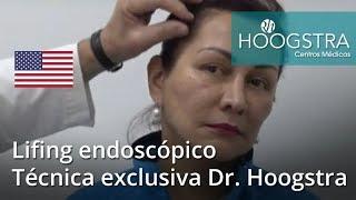 Lifing endoscópico - Técnica exclusiva Dr. Hoogstra (19066)