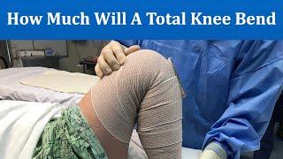 How much will a Total Knee bend? Getting the full range of motion from a knee replacement