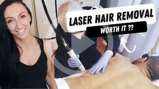 Is Laser Hair Removal Worth It? | Gentle Max Pro | Sparkle Lifestyle & MediSpa