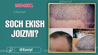 2418-Савол: Соч экиш жоизми? Шайх Абдуллоҳ Зуфар Ҳафизаҳуллоҳ | Soch ekish joizmi? Abdulloh Zufar