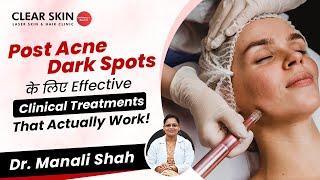 Post Acne Dark Spots के लिए Effective Clinical Treatments | Treatment for Dark Spots|Clear Skin,Pune