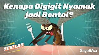 Digigit Nyamuk Bisa Bikin Bentol? | SeKiLas