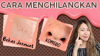 CARA MENGHILANGKAN BEKAS JERAWAT DAN KOMEDO | EXFOLIATE | EXFOLIATION | EXFOLIATOR | EKSFOLIASI