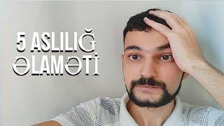 Suxoy vurmaqdan 5 aslılığ əlaməti