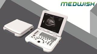 Laptop Black And White Ultrasound Machine Diagnostic System