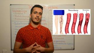 Tiefe Venenthrombose / TVT - Angiologie - Innere Medizin