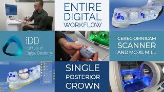 Entire Digital Workflow for CEREC Omnicam Scanner and MC XL Mill for a Single Posterior Crown