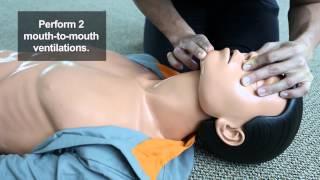 Mouth to Mouth Ventilations (CPR Steps)