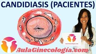 CANDIDIASIS VAGINAL (PACIENTES): Causas, síntomas, tratamiento   - Ginecología y Obstetricia -
