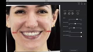 AI 3D Smile Design with SmileFy 4.0 | Webinar