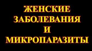 Киста, фиброма, миома, эндометриоз у женщин.