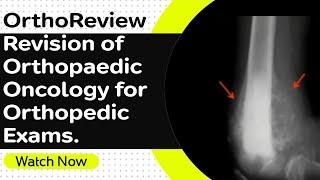 OrthoReview - Revision of Orthopaedic Oncology for Orthopedic Exams. Orthopaedic Academy