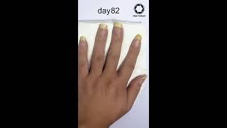 Fingernail Growing Time lapse - 90days #Shorts