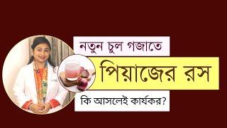 নতুন চুল গজাতে পিয়াজের রস কি আসলেই কার্যকর? । চুল পড়া বন্ধের সহজ উপায় । চুল গজানোর উপায়