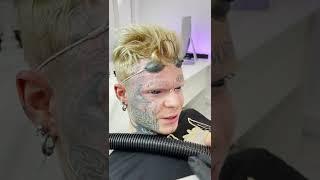 Даня Белый удаляет татуировки на лице