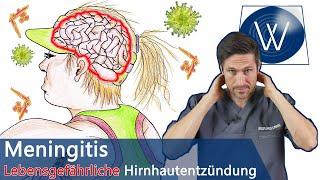 Lebensgefahr Meningitis  Achten Sie auf diese Symptome - So gefährlich ist die Hirnhautentzündung!