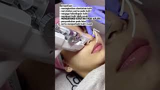 Treatment DNA SALMON Solusi Tepat WAJAH Cerah Bebas Kerutan | Lavees Clinic