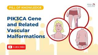 PIK3CA Gene and Related Vascular Malformations